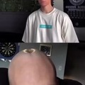 commented item thumbnail