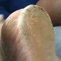 commented item thumbnail