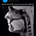 This is a real-time MRI scan of a person speaking (german).