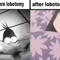 I had a lobotomy tbh