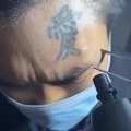Removing a tattoo