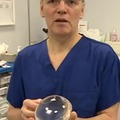 Swallowable Intragastric Balloon