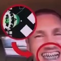 Bro got that death corridor teeth