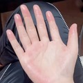 commented item thumbnail