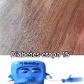 Diabetes tipo 15